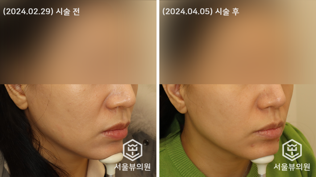 쥬베룩 볼륨3
