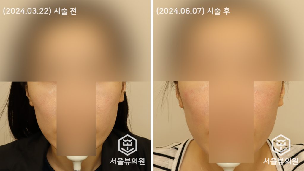 쥬베룩 볼륨2
