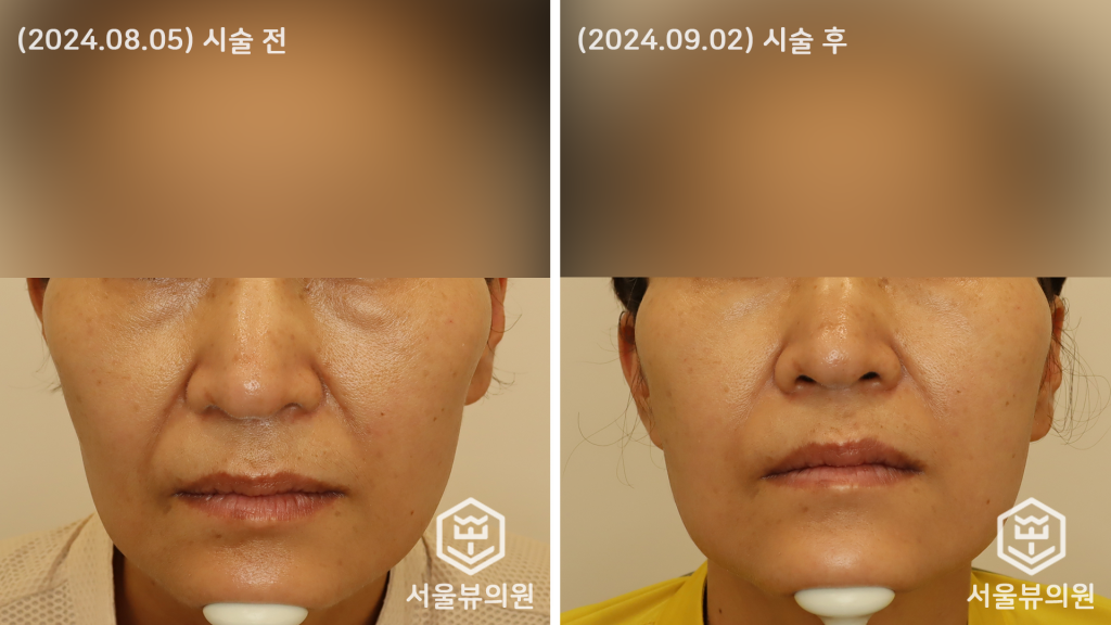 쥬베룩 볼륨1