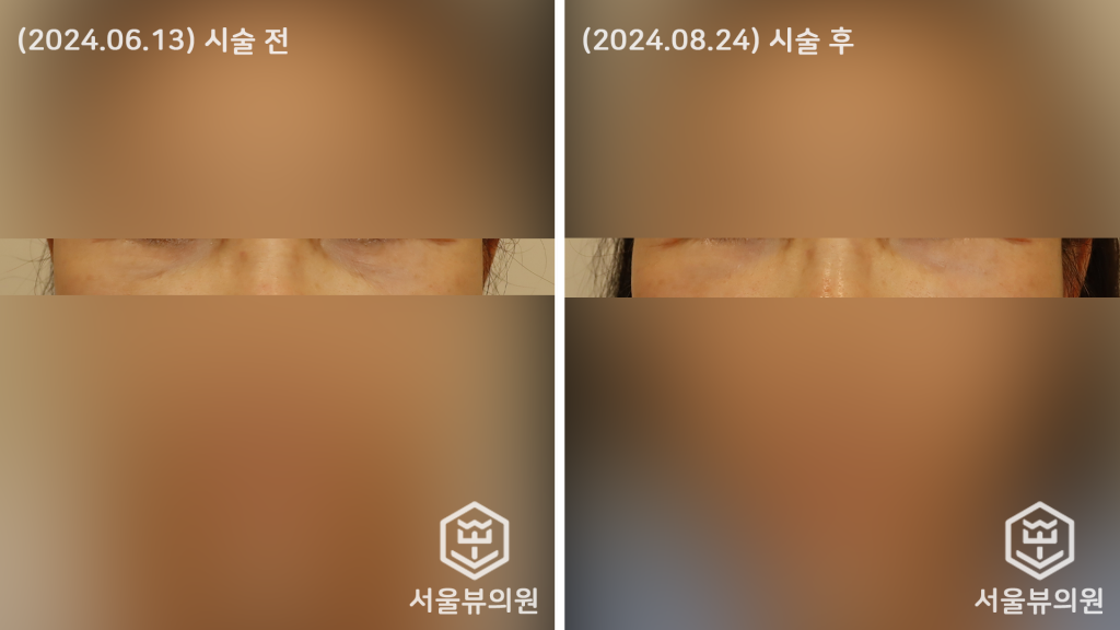 쥬베룩 볼륨4